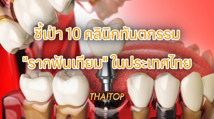 ชี้เป้า 10 คลินิกทันตกรรม "รากฟันเทียม" ในประเทศไทย